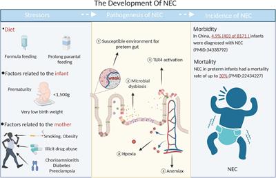 Current therapy option for necrotizing enterocolitis: Practicalities and challenge